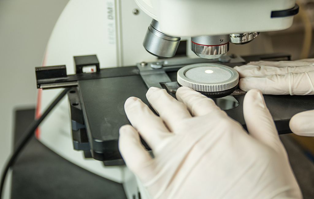 Analisi al microscopio delle particelle residue del Cleanliness Test